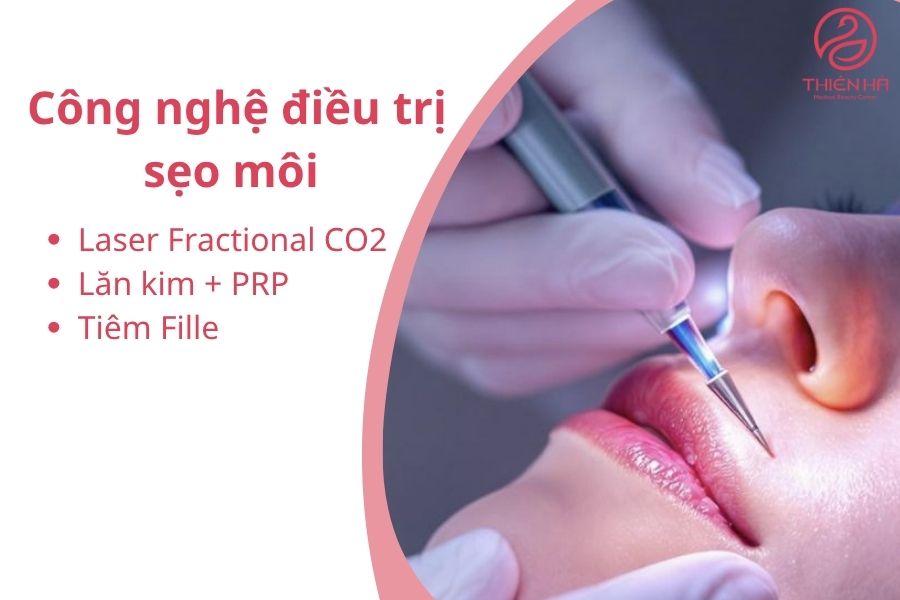 Các công nghệ điều trị sẹo môi
