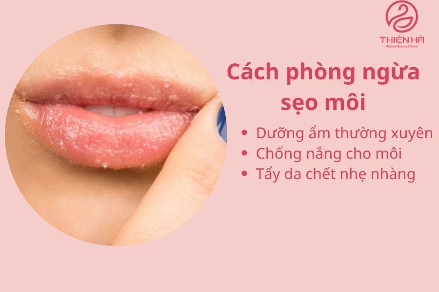 Cách phòng ngừa sẹo môi