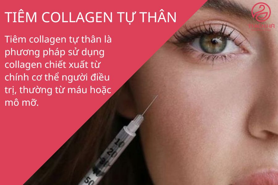 Tiêm Collagen tự thân