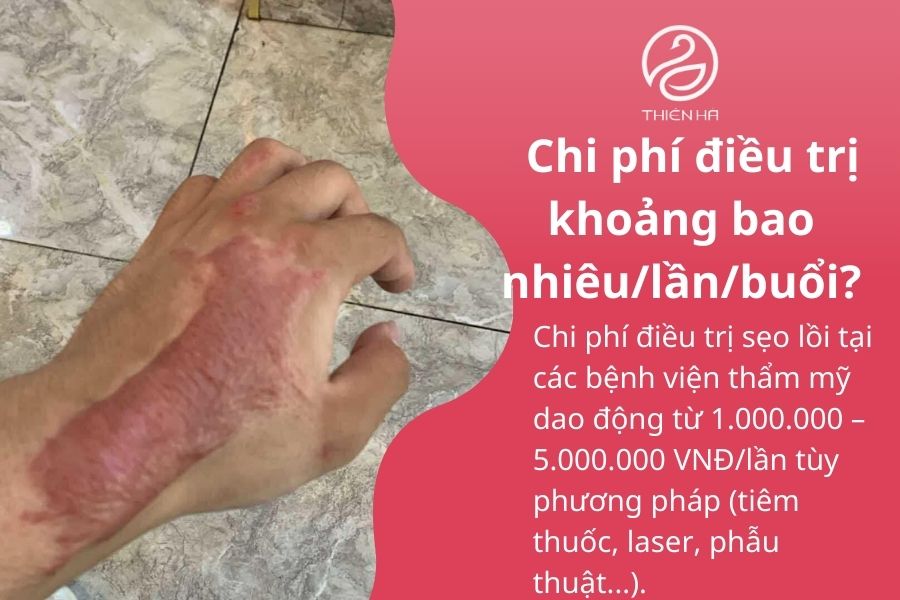 Một số câu hỏi thường gặp 