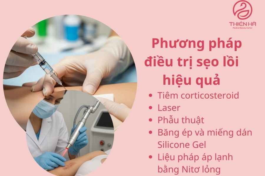 Các phương pháp điều trị sẹo lồi hiệu quả tại bệnh viện thẩm mỹ