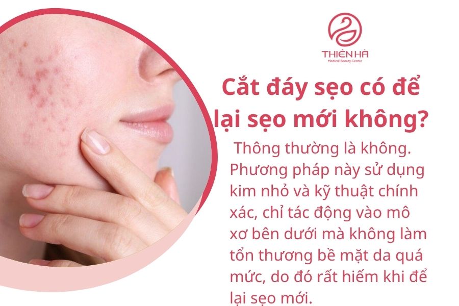 Một số câu hỏi thường gặp 