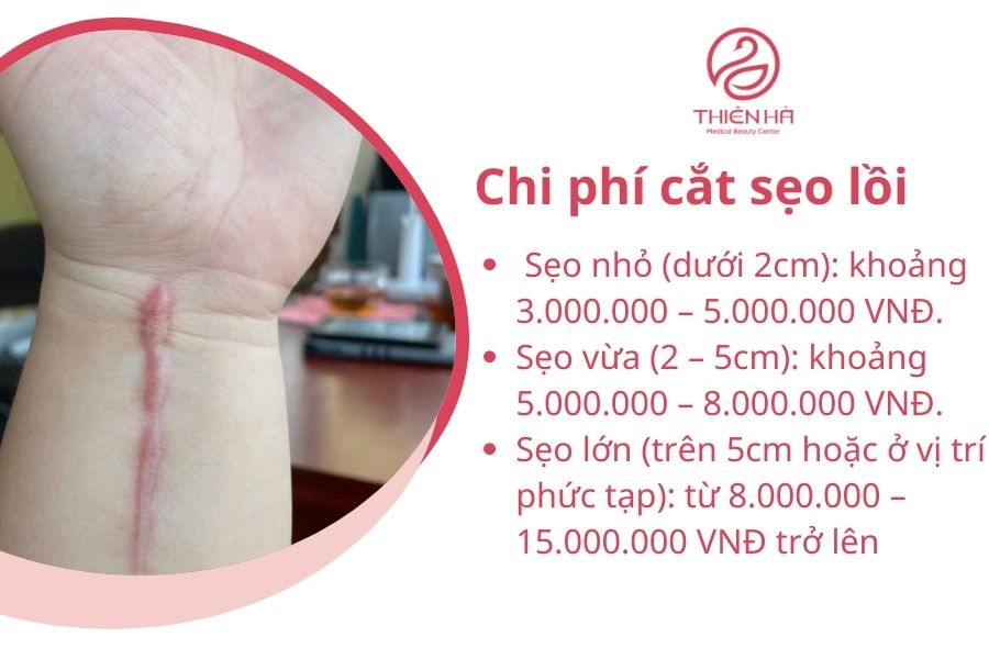 Chi phí cắt sẹo lồi là bao nhiêu ?