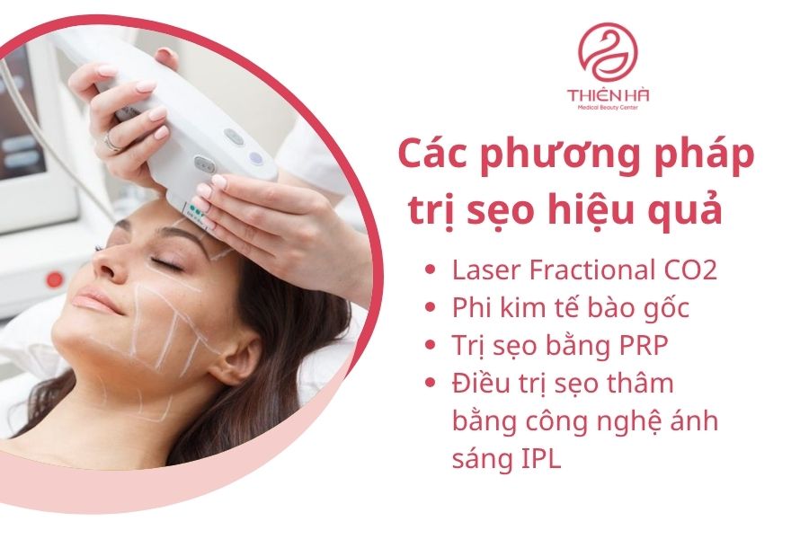 Phương pháp trị sẹo hiệu quả 