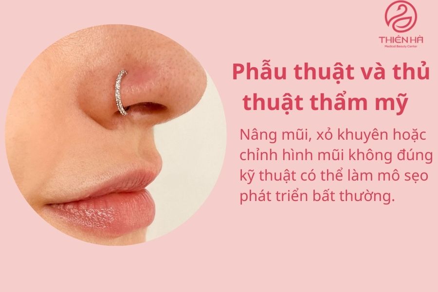 Nguyên nhân gây ra sẹo lồi ở mũi 