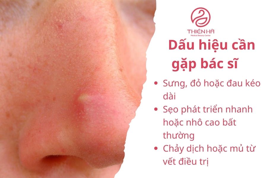Dấu hiệu cần gặp bác sĩ 