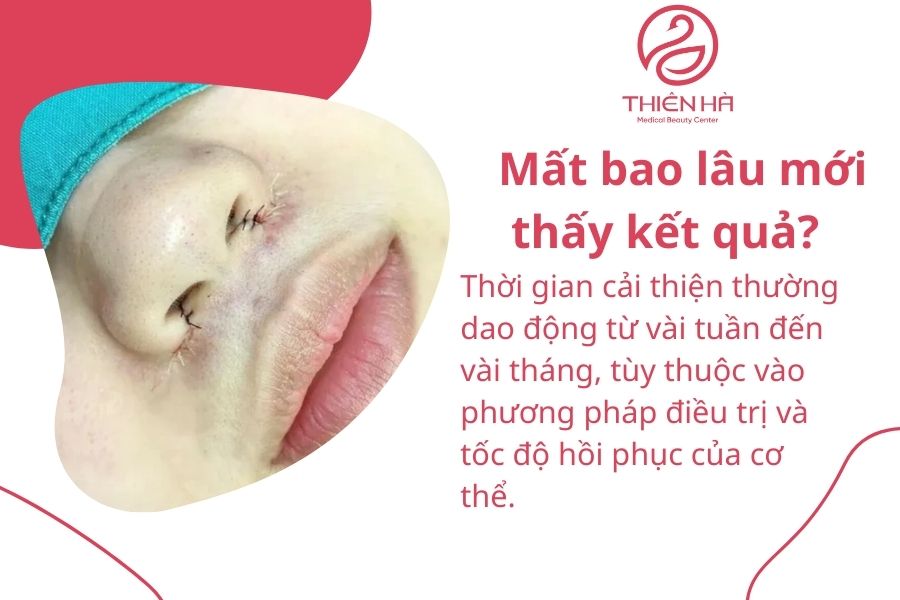 Một số câu hỏi thường gặp 