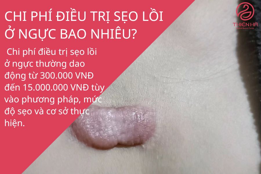 Chi phí điều trị sẹo lồ ở ngực giá bao nhiêu ?