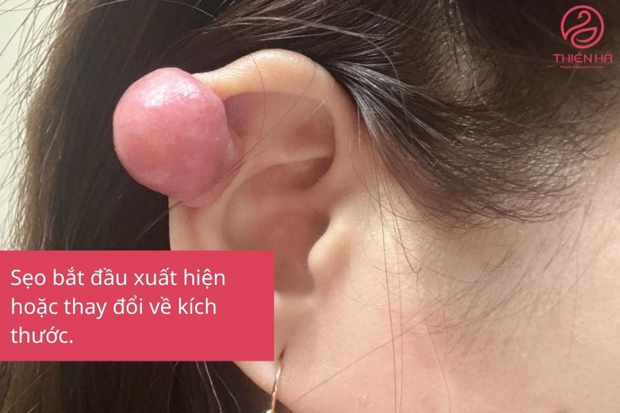Dấu hiệu bất thường ở tai dễ nhận thấy