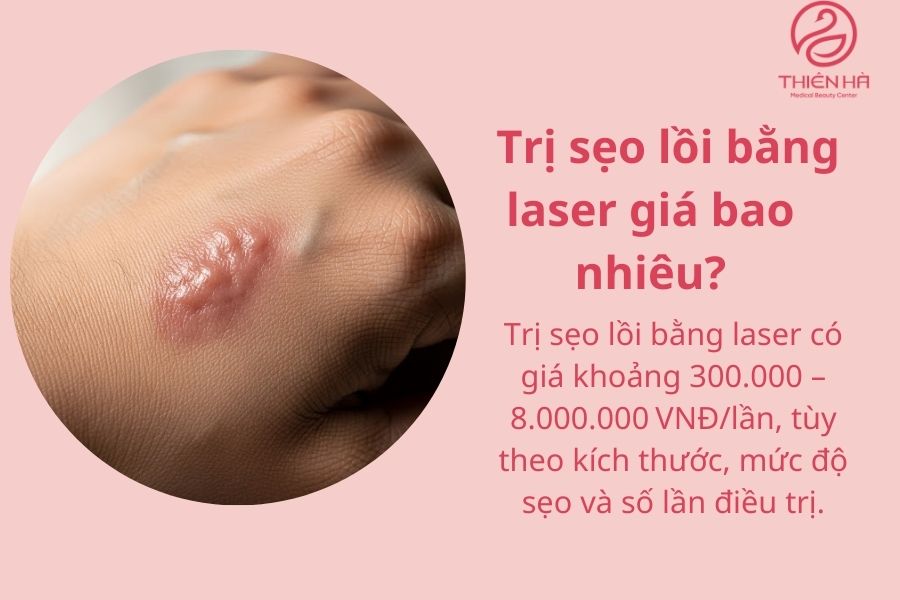 Trị sẹo lồi bằng laser giá bao nhiêu?
