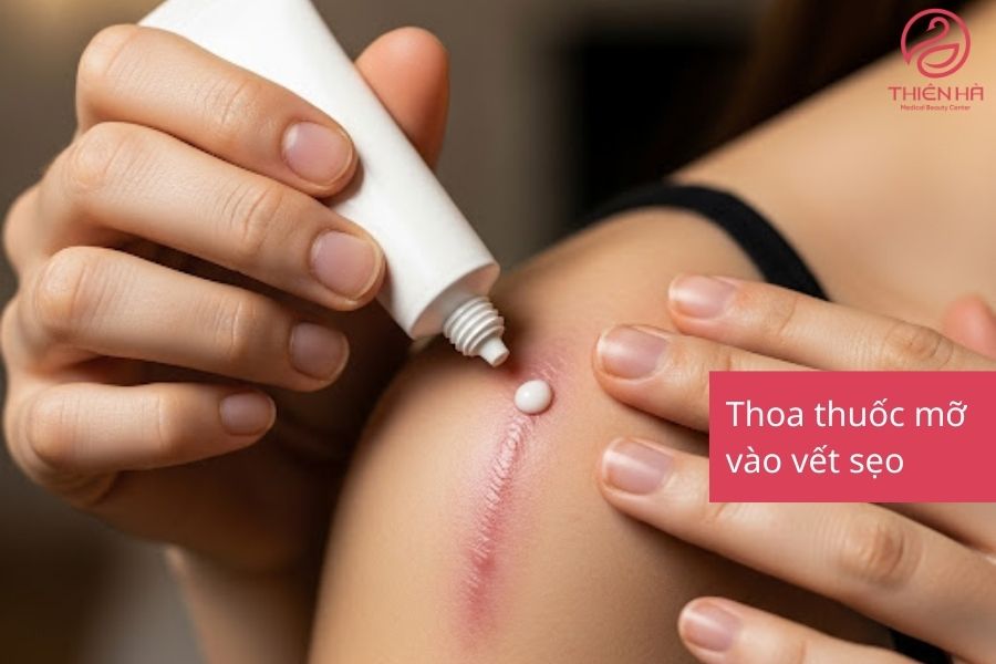 Thoa thuốc mỡ vào vết sẹo