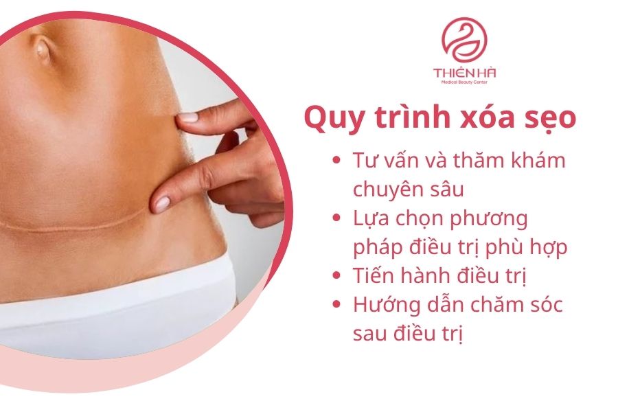 Quy trình xóa sẹo tại Thẩm mỹ viện Thiên Hà