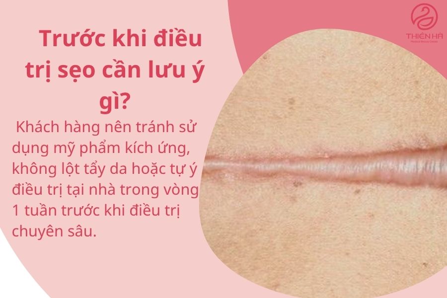 Một số câu hỏi thường gặp 