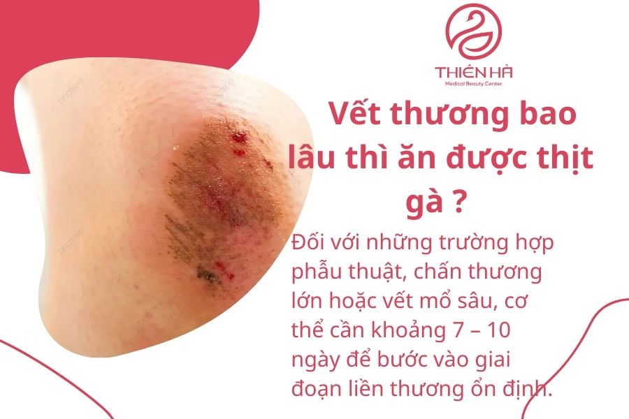 Vết thương bao lâu thì ăn được thịt gà ? 