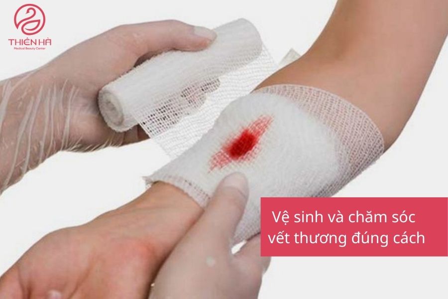Cách ngăn ngừa sẹo lồi hiệu quả