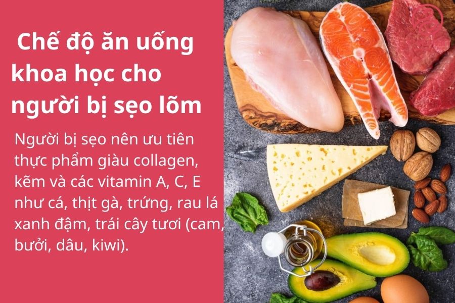 Chế độ ăn uống khoa học cho người bị sẹo lõm