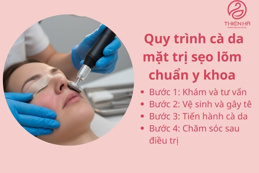 Quy trình cà da mặt trị sẹo lõm chuẩn y khoa