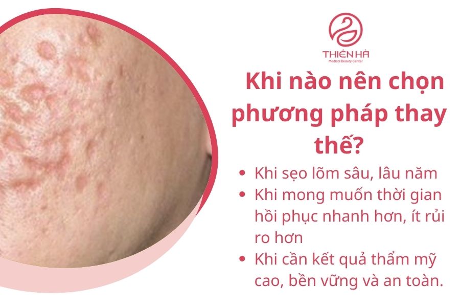 Khi nào nên chọn phương pháp thay thế cà da mặt trị sẹo lõm 