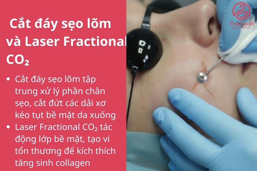 So sánh cắt đáy sẹo lõm với các phương pháp khác