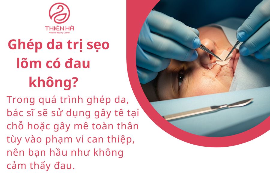 Một số câu hỏi thường gặp 