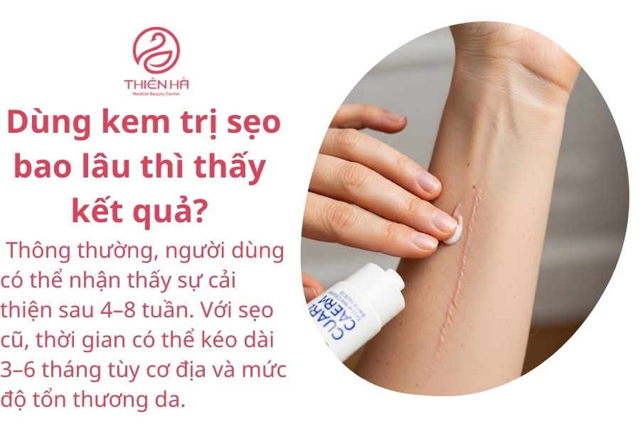 Một số câu hỏi thường gặp 