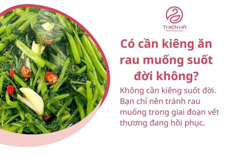 Một số câu hỏi thường gặp 