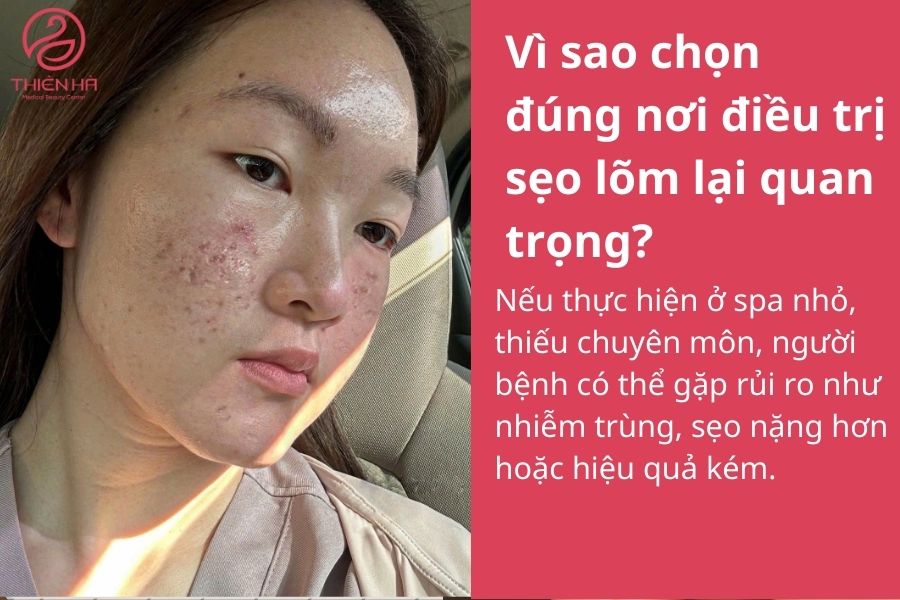 Vì sao chọn đúng nơi điều trị sẹo lõm lại quan trọng?
