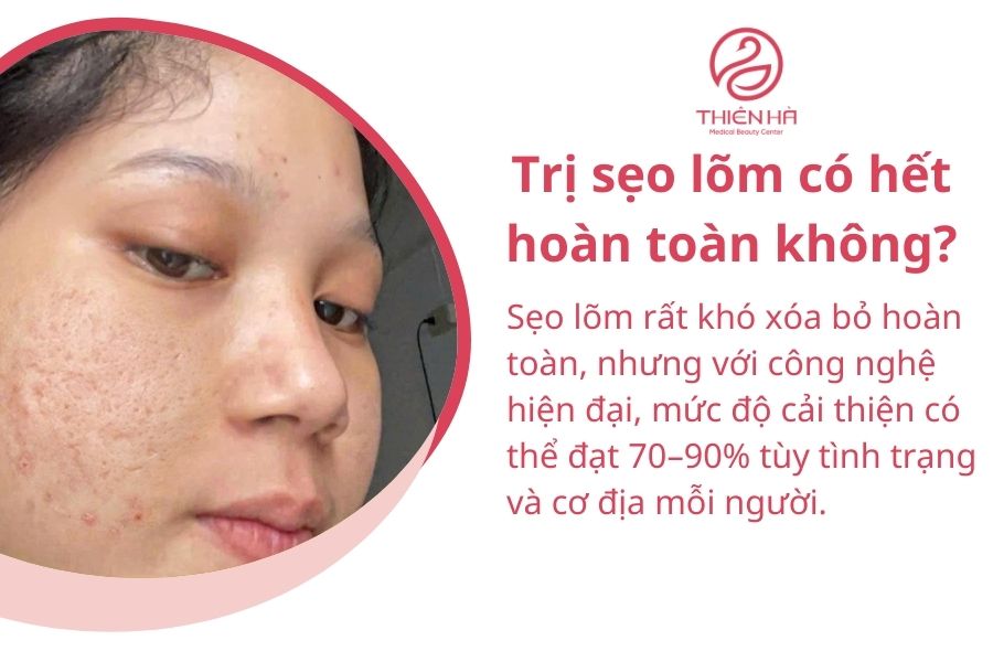 Một số câu hỏi thường gặp