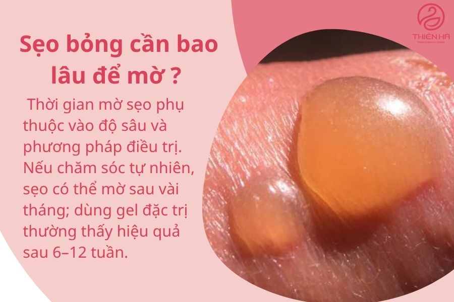 Câu hỏi thường gặp về sẹo bỏng