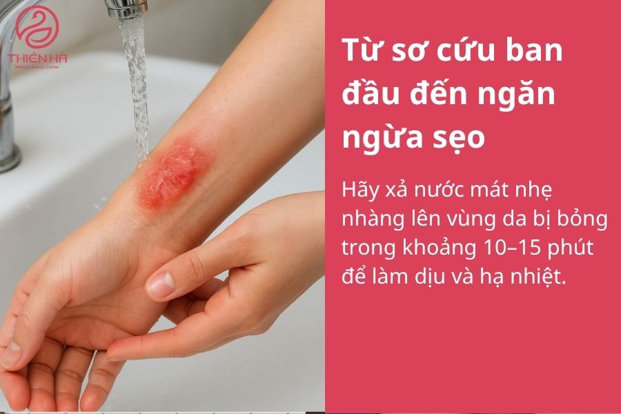 Sơ cứu sẹo bỏng ban đầu