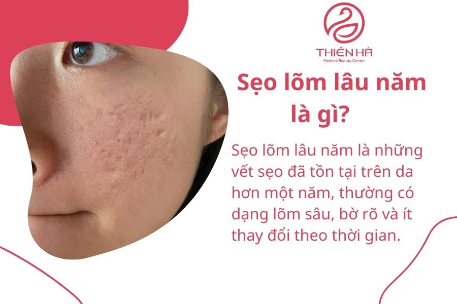 Sẹo lõm lâu năm là gì?