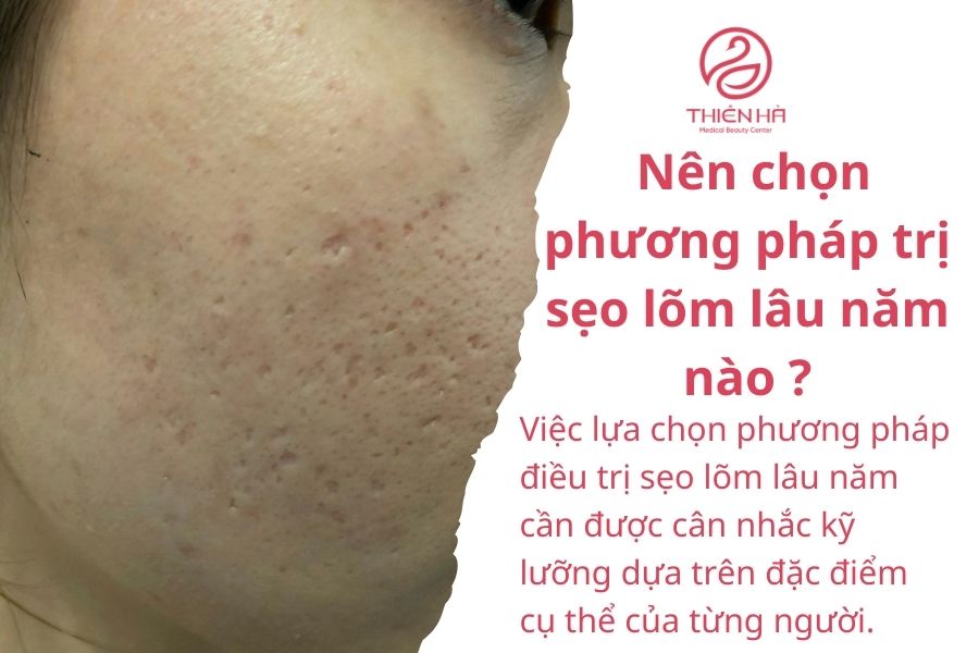Nên chọn phương pháp trị sẹo lõm lâu năm nào