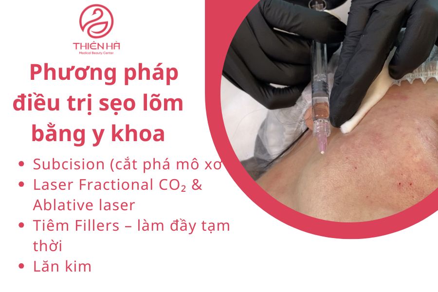 Các phương pháp điều trị sẹo lõm lâu năm hiệu quả 