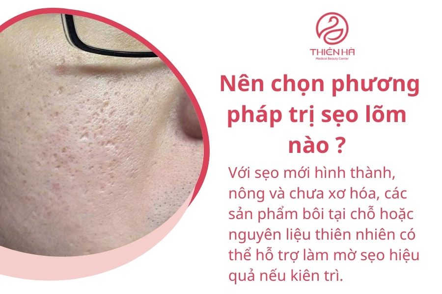 Nên chọn phương pháp trị sẹo lõm nào? 