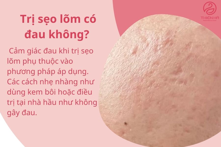Một số câu hỏi thường gặp 