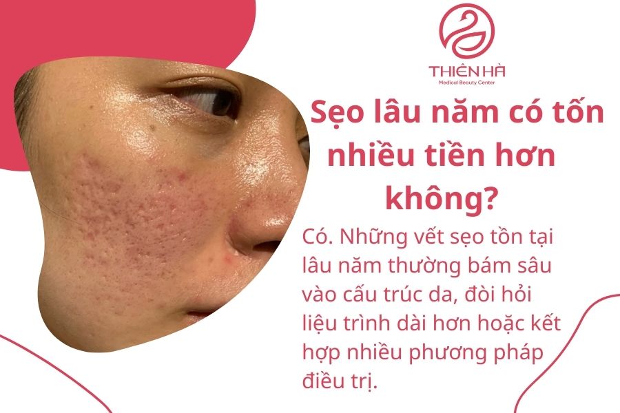 Một số câu hỏi thường gặp 