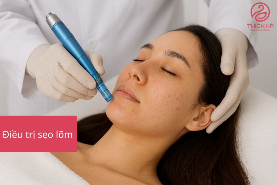 Điều trị sẹo lõm