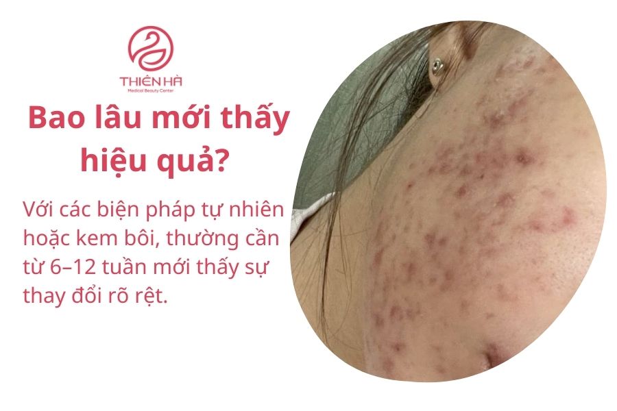 Một số câu hỏi thường gặp 