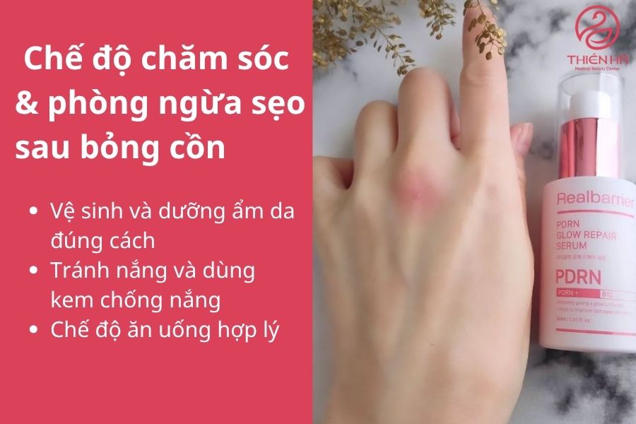 Chế độ chăm sóc & phòng ngừa sẹo sau bỏng cồn