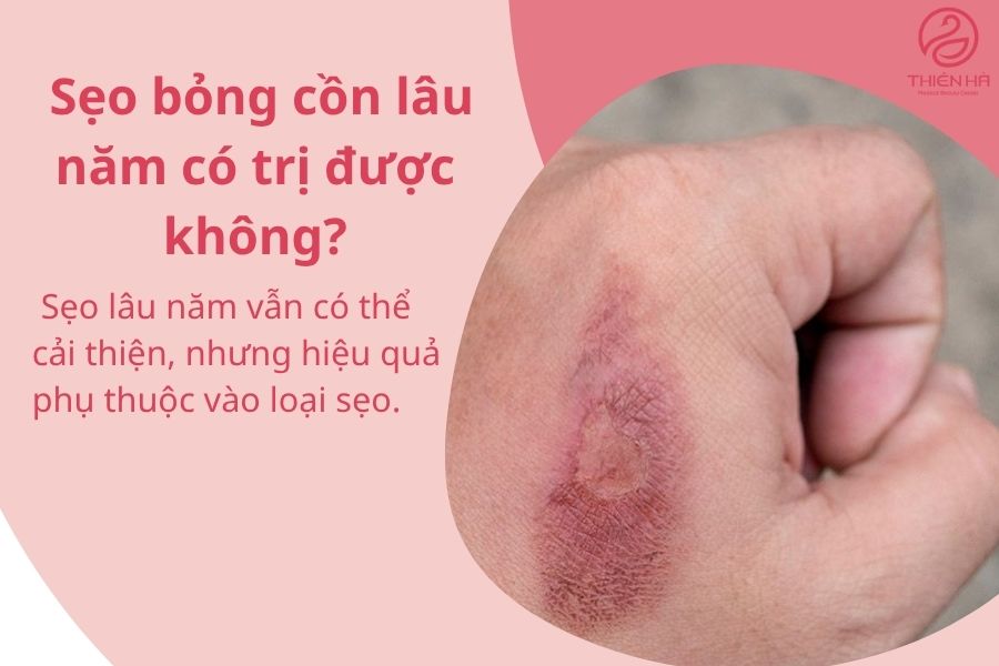 Một số câu hỏi thường gặp 