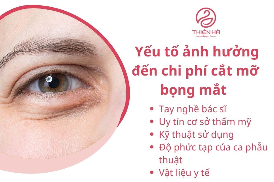 Các yếu tố ảnh hưởng đến chi phí
