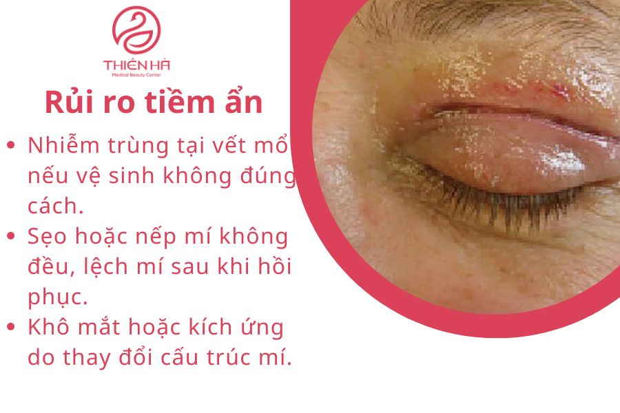 Rủi ro tiềm ẩn 