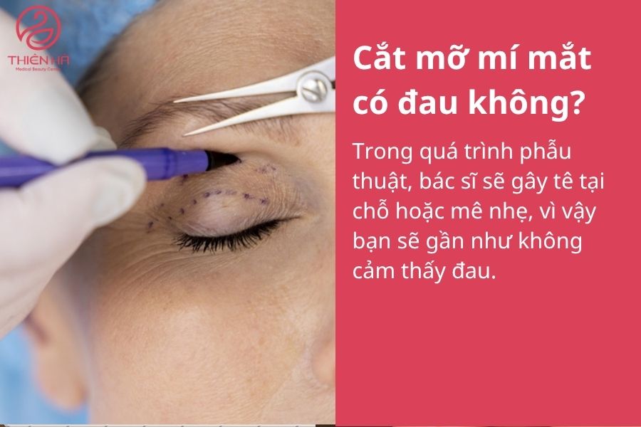 Một số câu hỏi thường gặp : Cắt mỡ mí mắt có đau không 