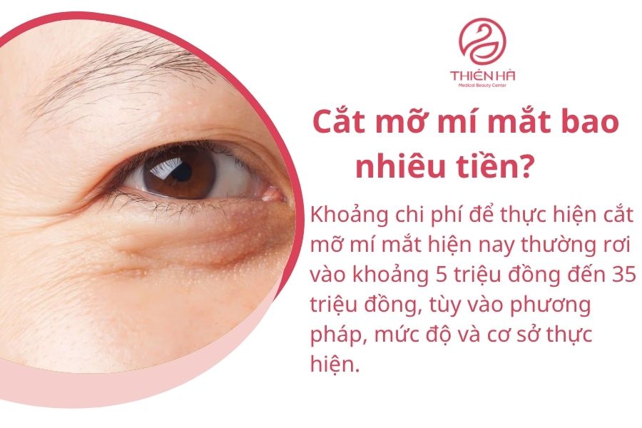 Cắt mỡ mí mắt bao nhiêu tiền?