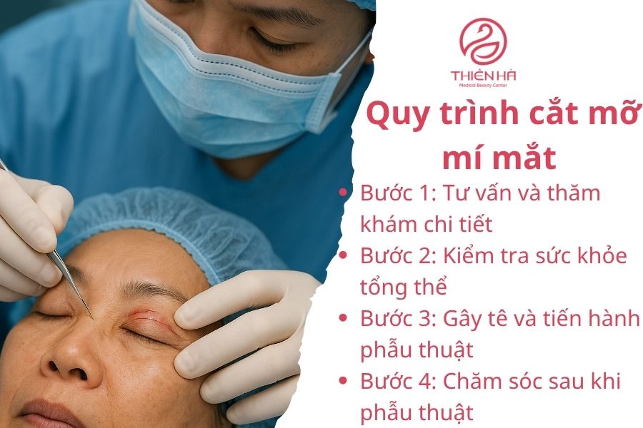 Quy trình cắt mỡ mí mắt 