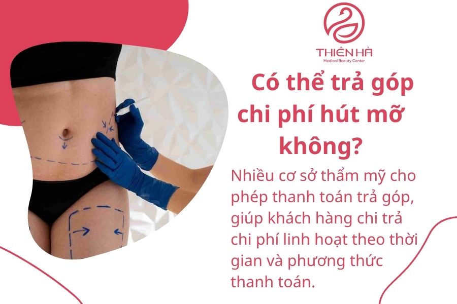 Có thể trả góp chi phí hút mỡ không?