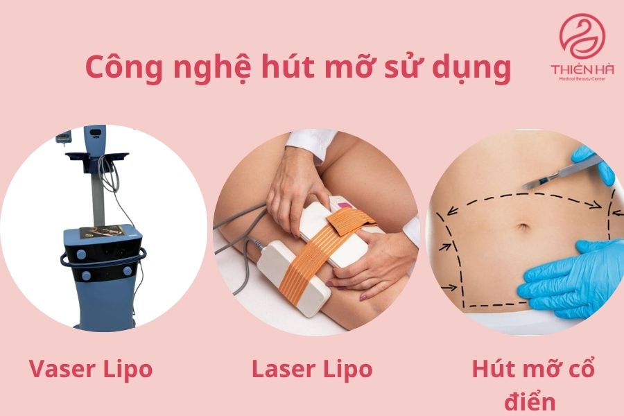 Công nghệ hút mỡ sử dụng