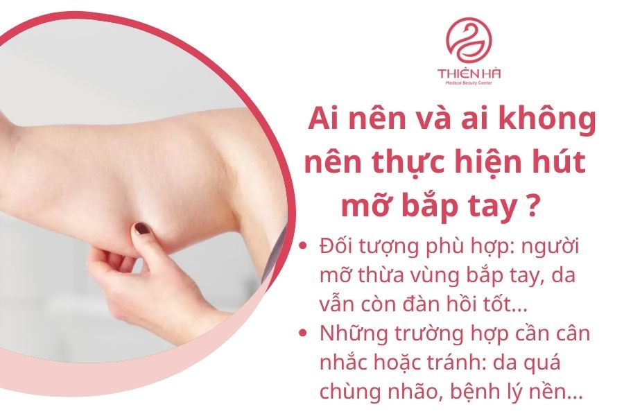 Ai nên và ai không nên thực hiện hút mỡ bắp tay