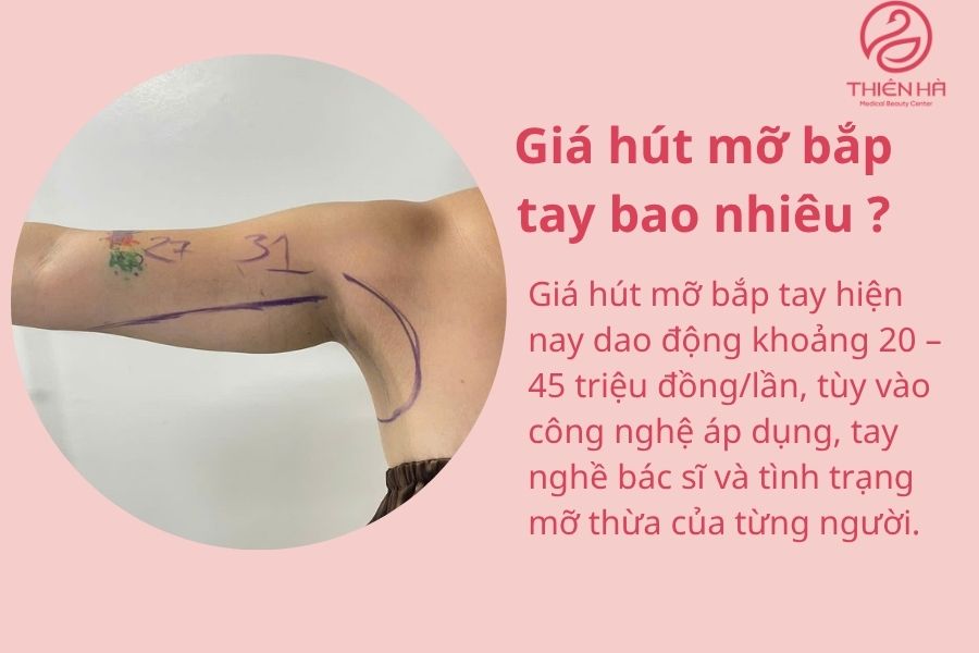  Giá hút mỡ bắp tay bao nhiêu 