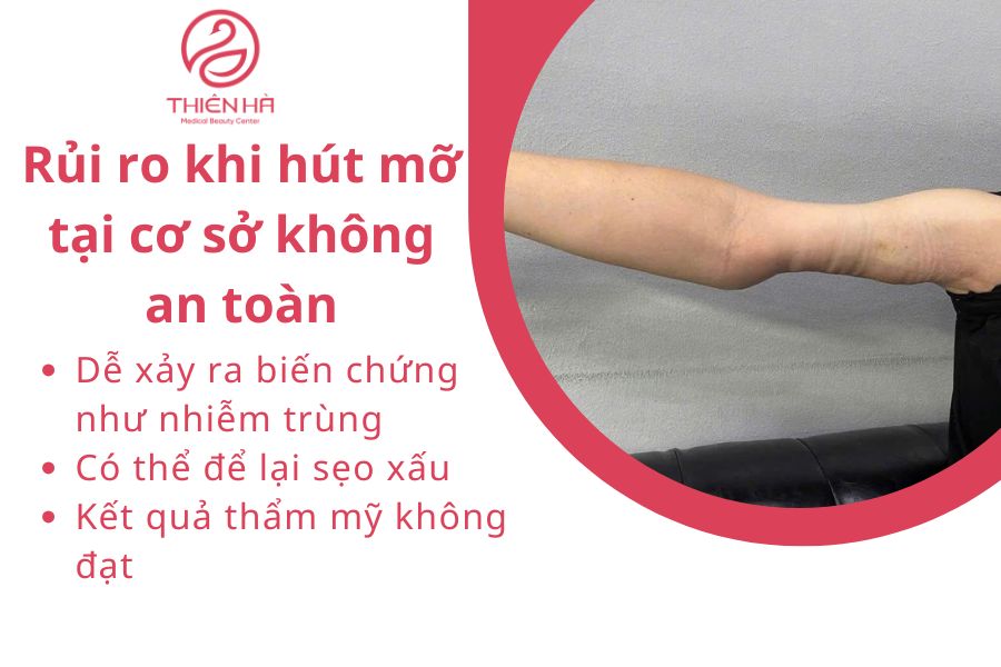 Rủi ro khi hút mỡ tại cơ sở không an toàn